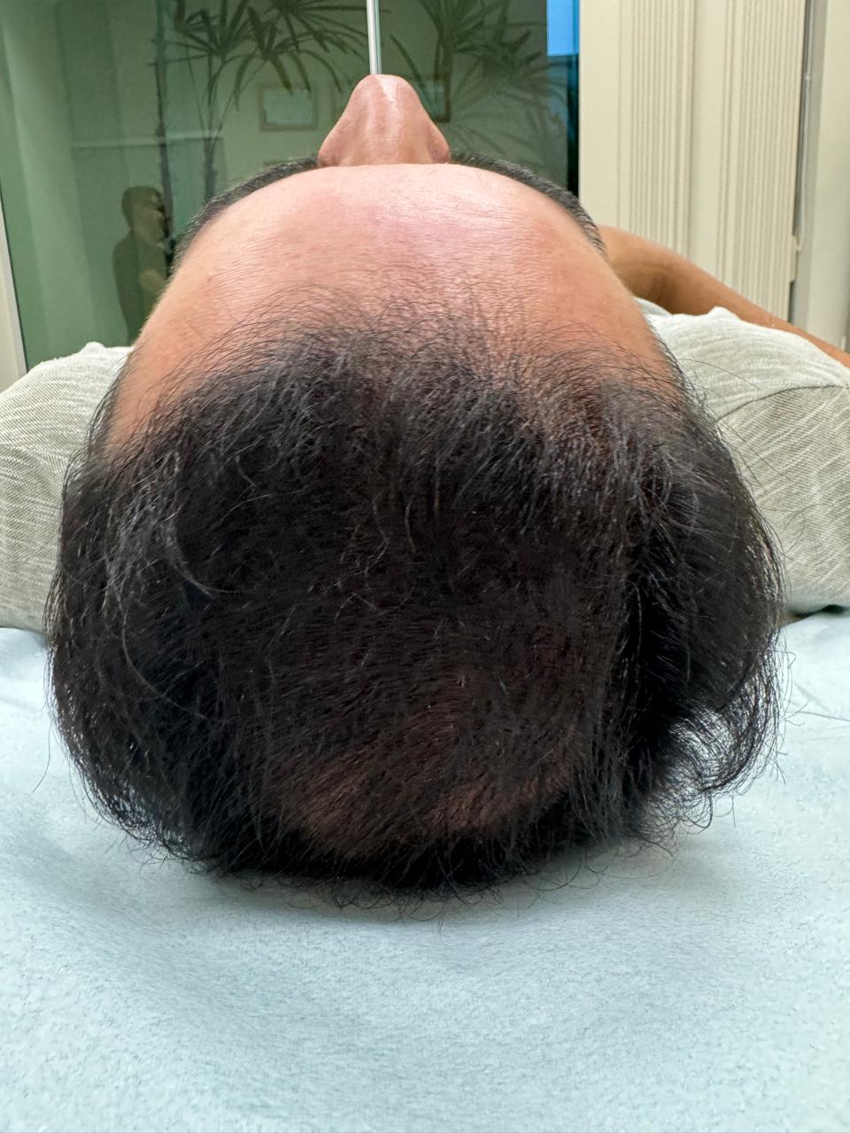 Antes e depois de protocolo capilar realizado por Jéssica Bordignon — depois